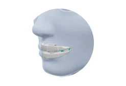 Anti Snoring Mouthpiece Device