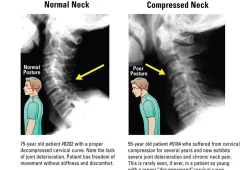 At Home Neck and Back Pain Reliever