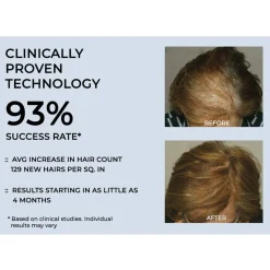 Cordless Hair Growth Comb