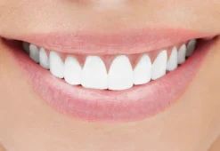 Healthy Gum Professional Teeth Whitening System