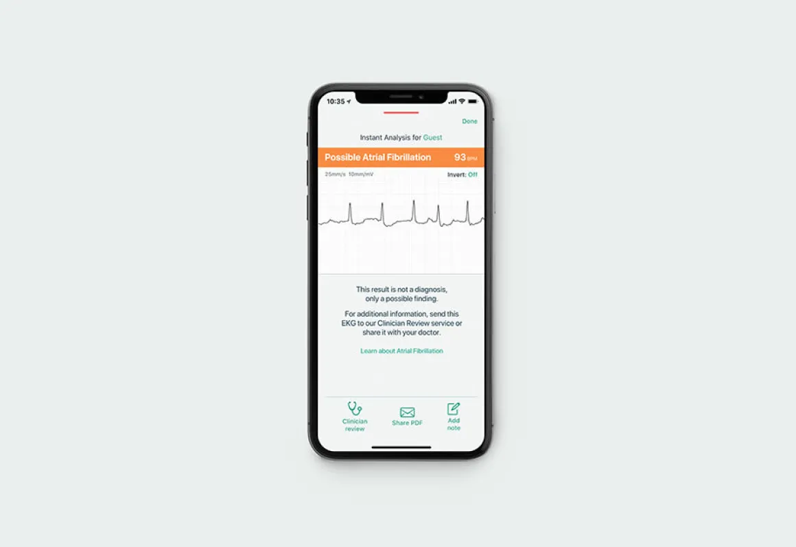 Portable EKG