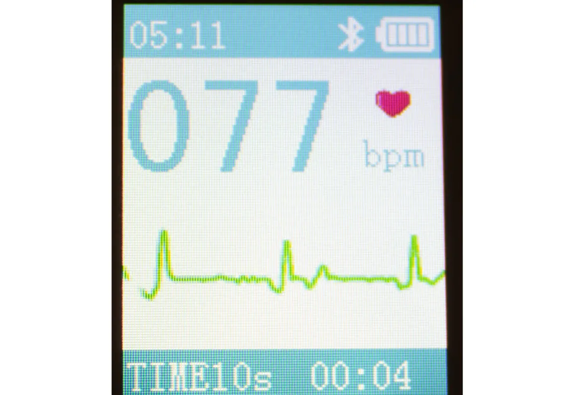 Portable Smart Bluetooth EKG Monitor