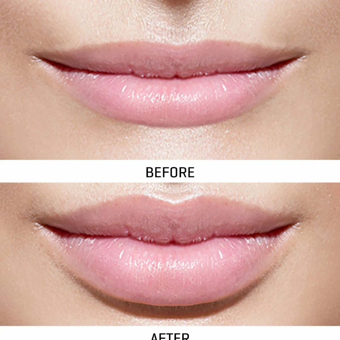 World's First At-Home Professional LED Lip Therapy Device